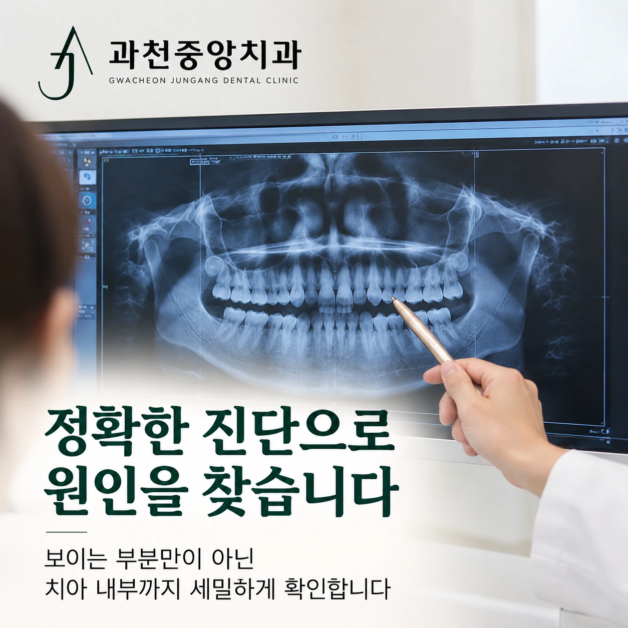 치아 내부까지 확인하는 진단