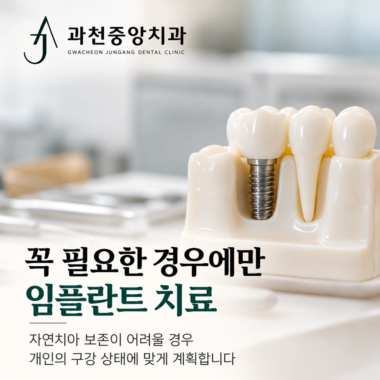 자연치아 보존이 어려울 때의 임플란트 치료 안내